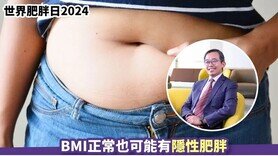 世界肥胖日2024丨BMI正常也可能有隱性肥胖 專科醫生：腰圍超標成高危族！ (Only available in Chinese)